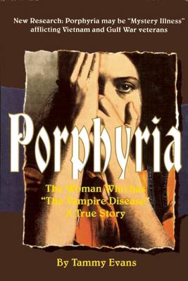 Porphyria: The Woman Who Has "the Vampire Disease"