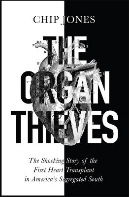 The Organ Thieves: The Shocking Story of the First Heart Transplant in