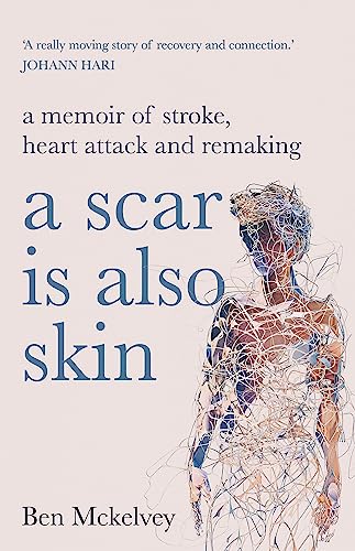 A Scar is Also Skin: A memoir of stroke, heart attack and remaking