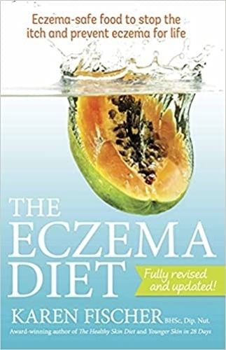 The Eczema Diet: Eczema-safe food to stop the itch and prevent eczema for life